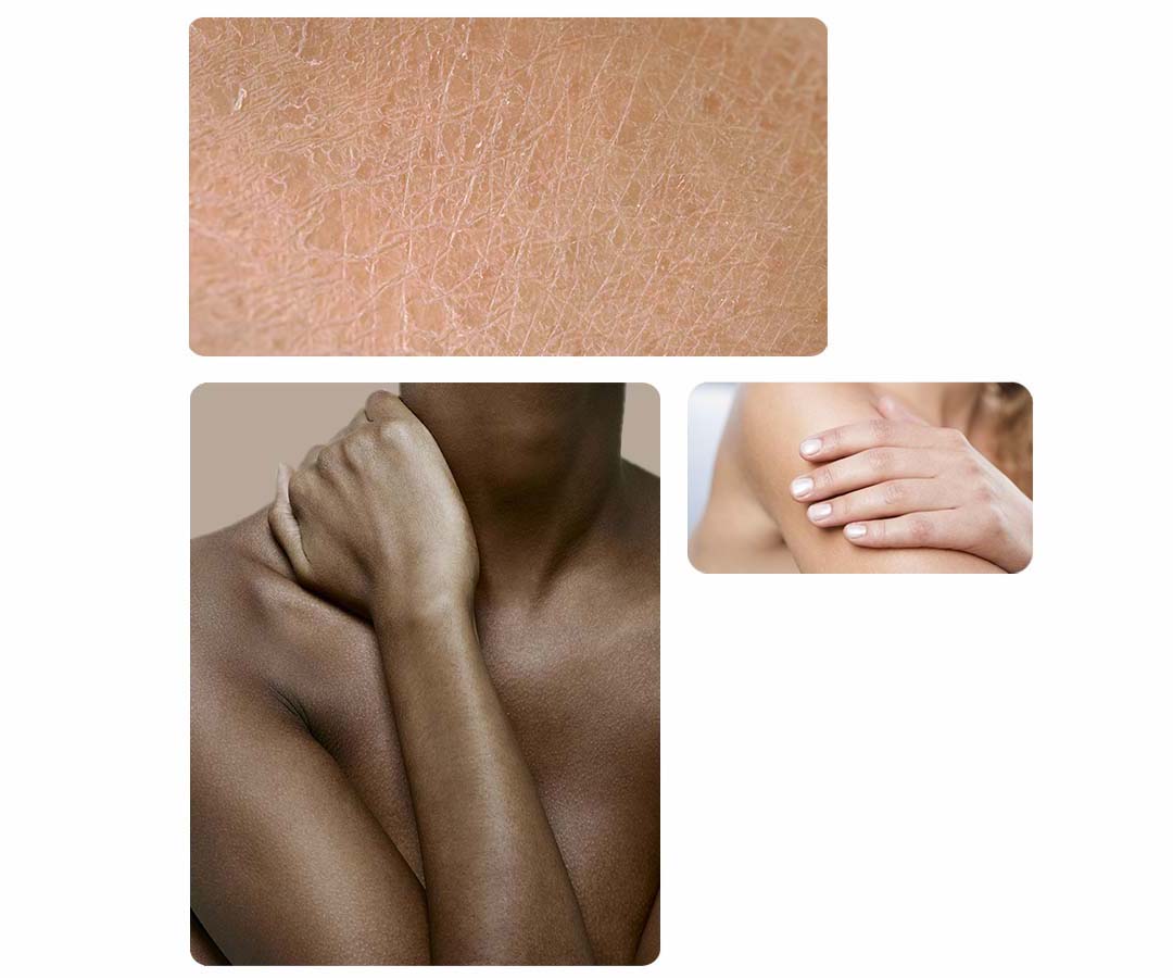 Showing image of dry skin and a woman touching her neck with her hands Woman touching her arm with her hand
