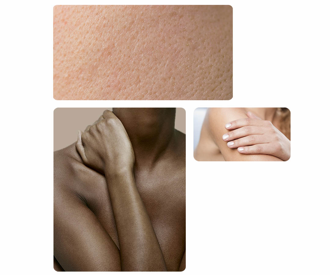 Showing image of oily skin, and a woman touching her neck with her hands. Woman touching her arm with her hand. 			 			