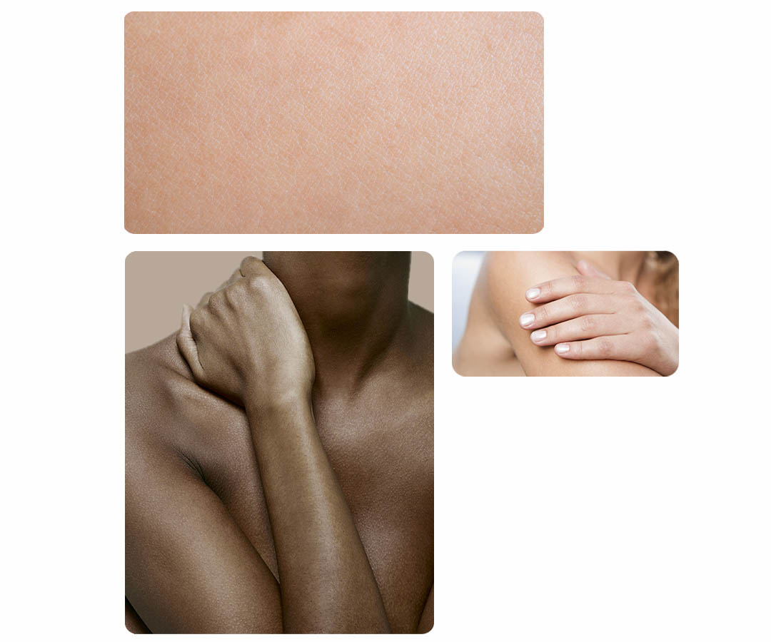 Showing image of sensitive skin and a woman touching her neck with her hands Woman touching her arm with her hand